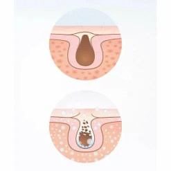 Facial Care